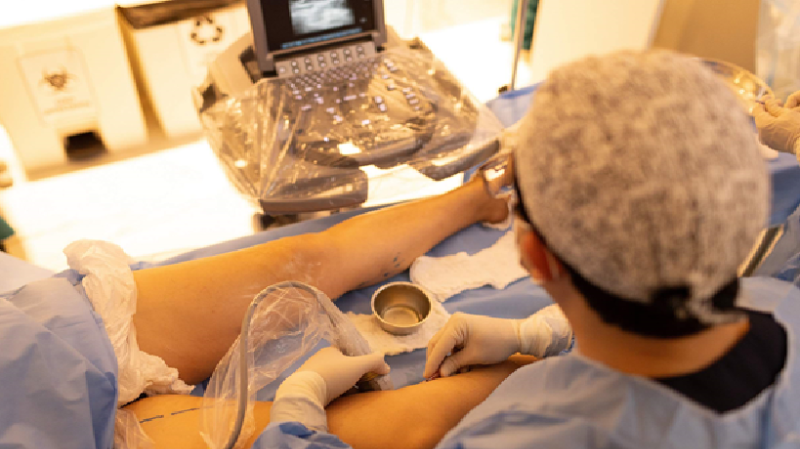 Procedimento de ablação térmica para tratamento de varizes com médico usando equipamento a laser, ultrassom em tela e paciente em clínica 