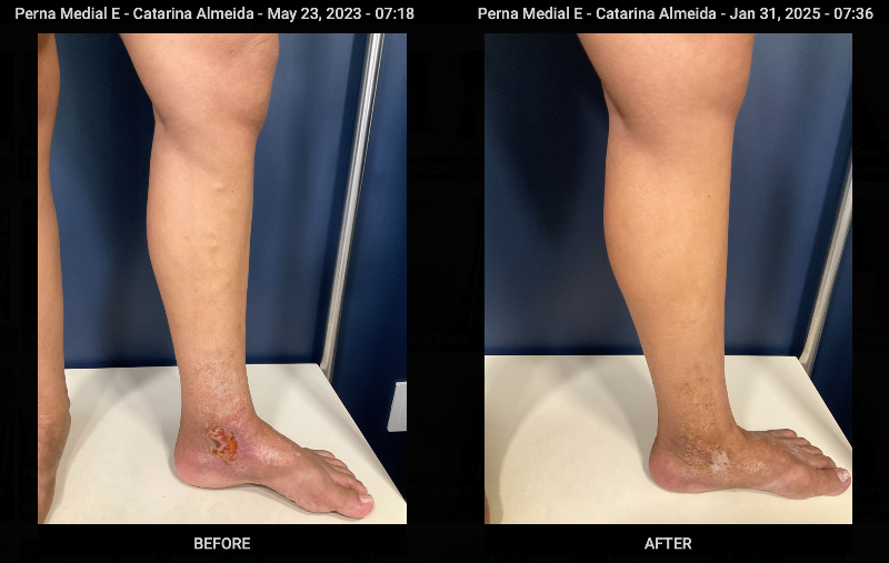 Pernas com úlcera vascular tratada, mostrando pele detalhada e saudável em ambiente clínico moderno 