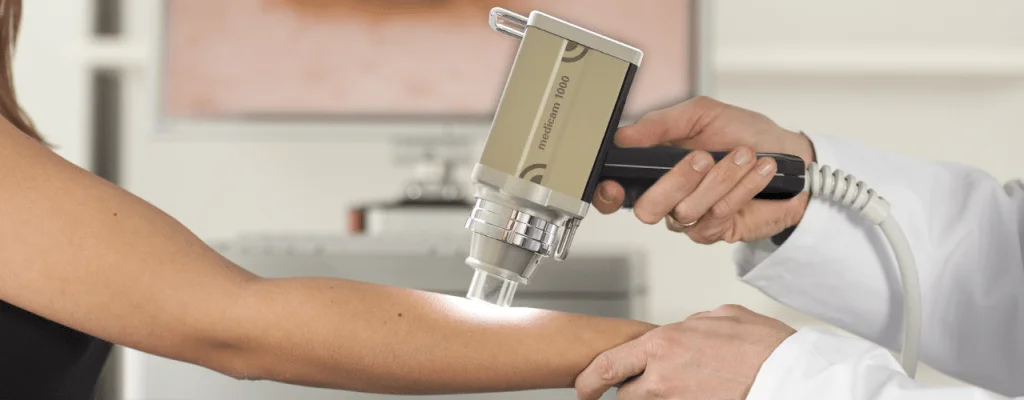 Dermatologista analisando pele com dermatoscópio e tela de mapeamento corporal digital ao fundo 