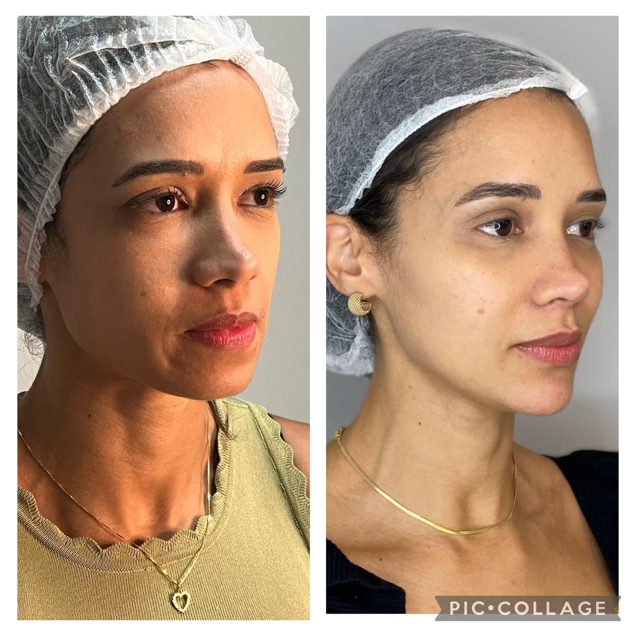 Grupo diverso comparando opções de harmonização facial em ambiente moderno 