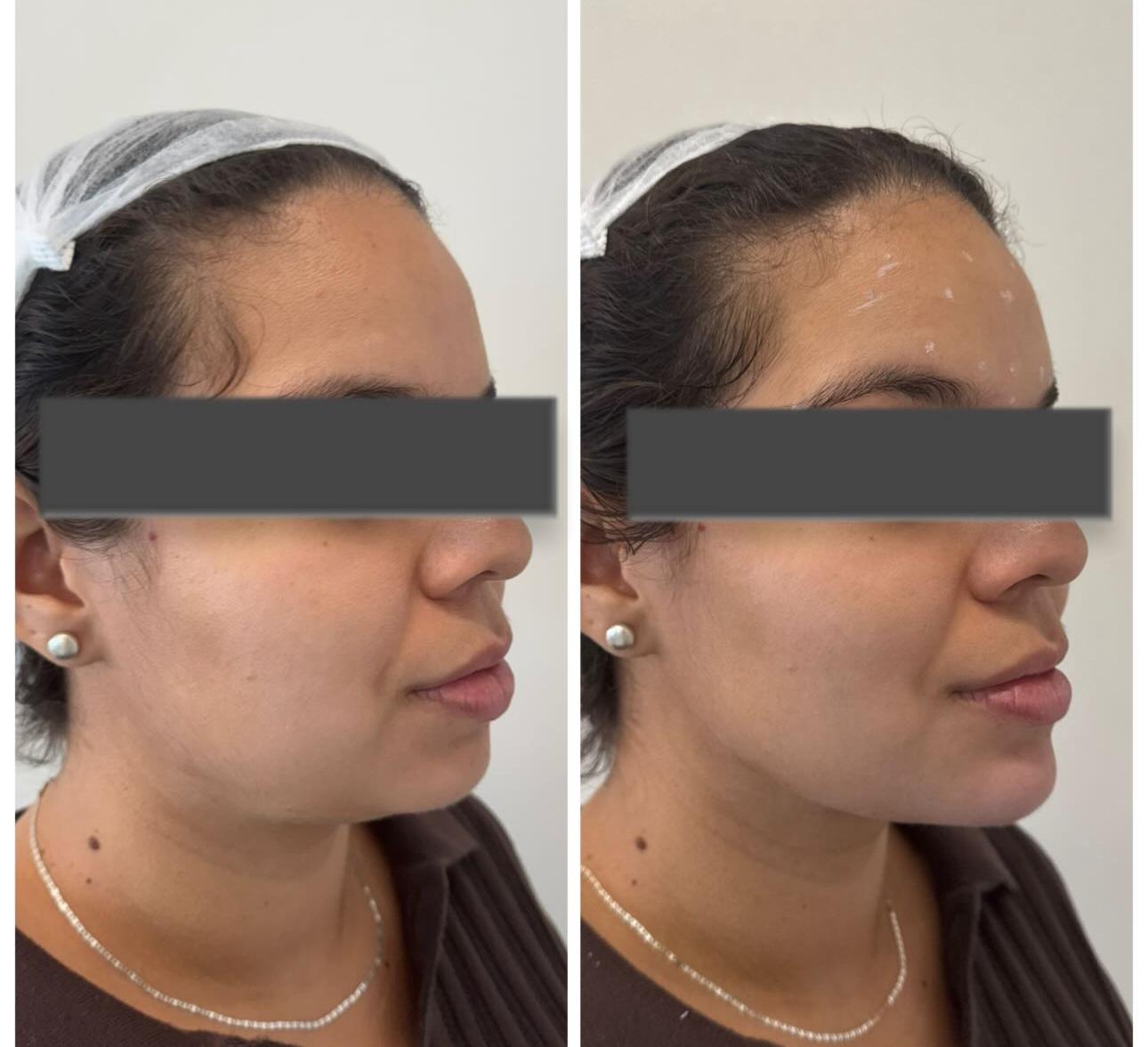 Grupo observando resultados de harmonização facial em frente a espelho de clínica elegante 